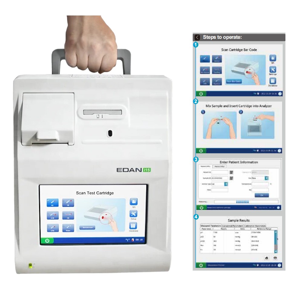 Edan i15VET veterinary blood gas and chemistry analyzer