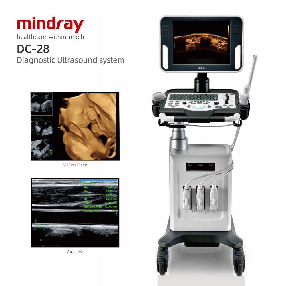 Mindray DC-28 color Doppler ultrasound system