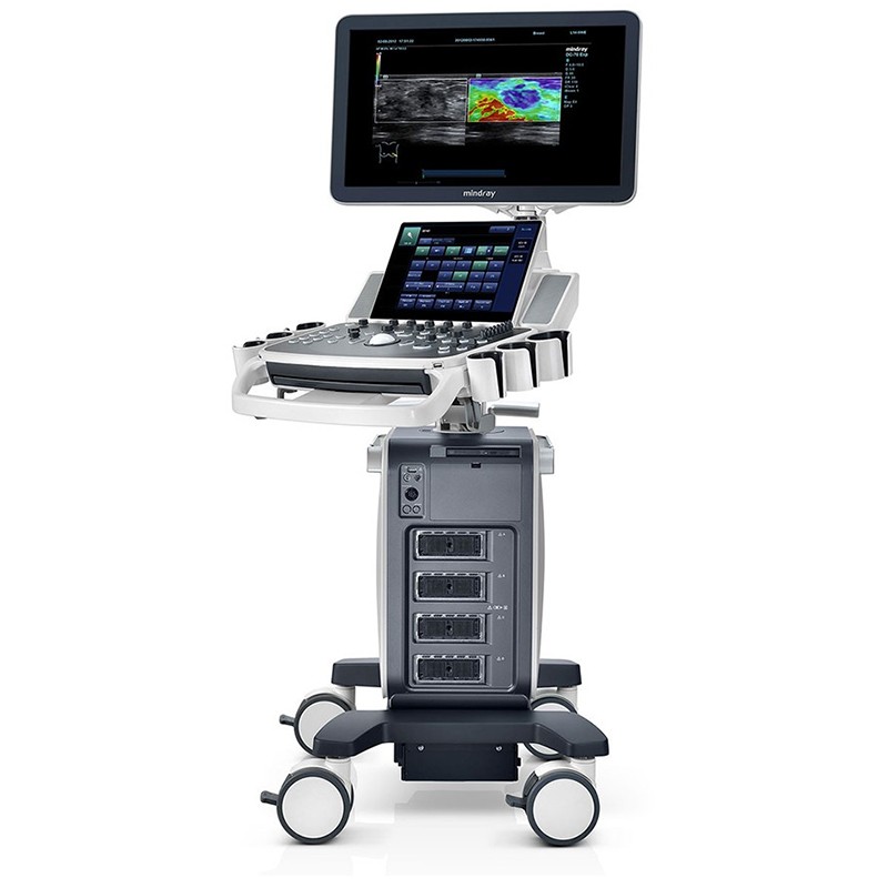 Mindray DC-70 Obstetrics & Gynecology Ultrasound System