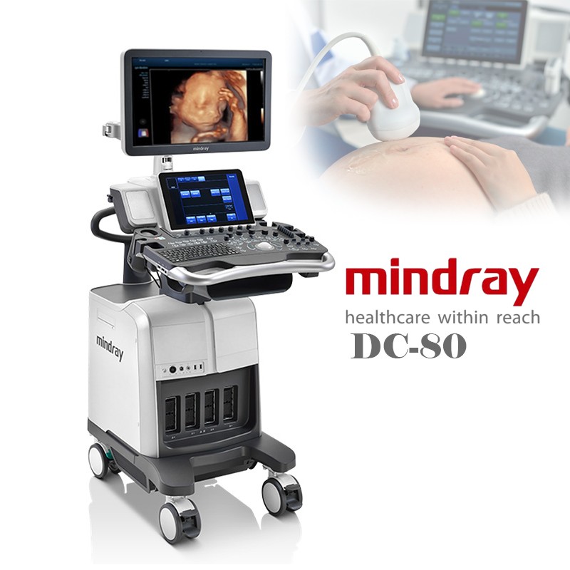 Mindray DC-80 with X-Insight Diagnostic Ultrasound System