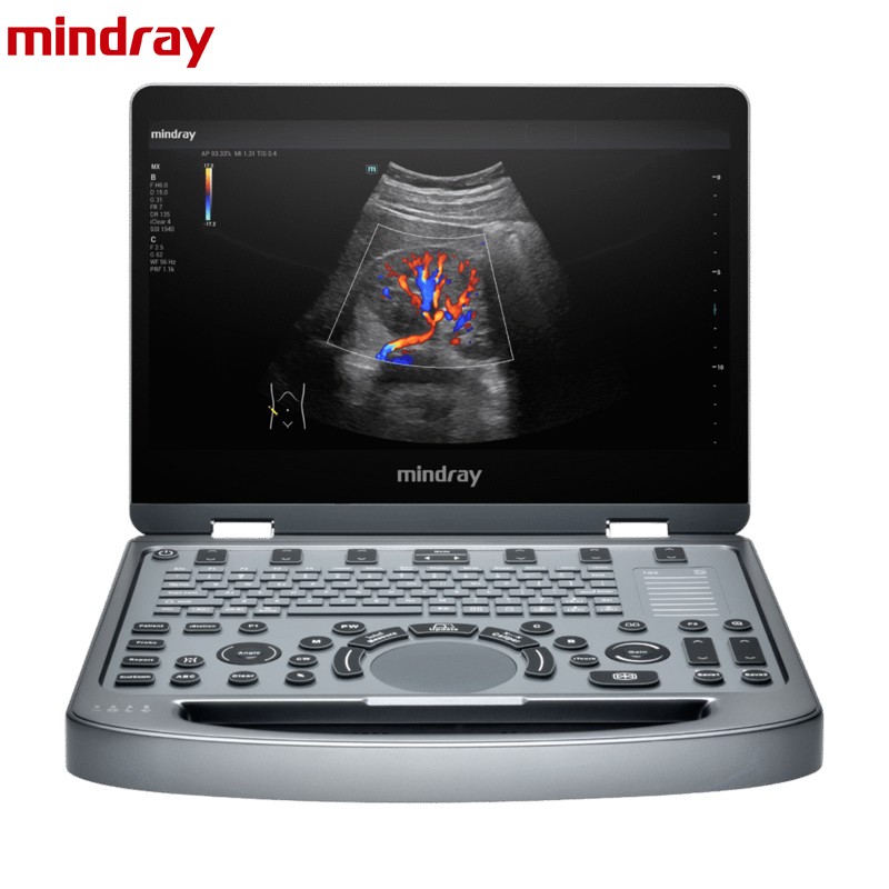 Mindray MX6 Compact Ultrasound System