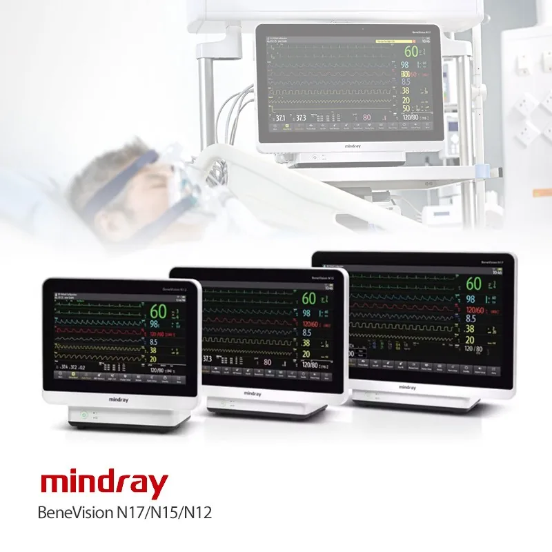 Mindray BeneVision N17 Patient Monitor
