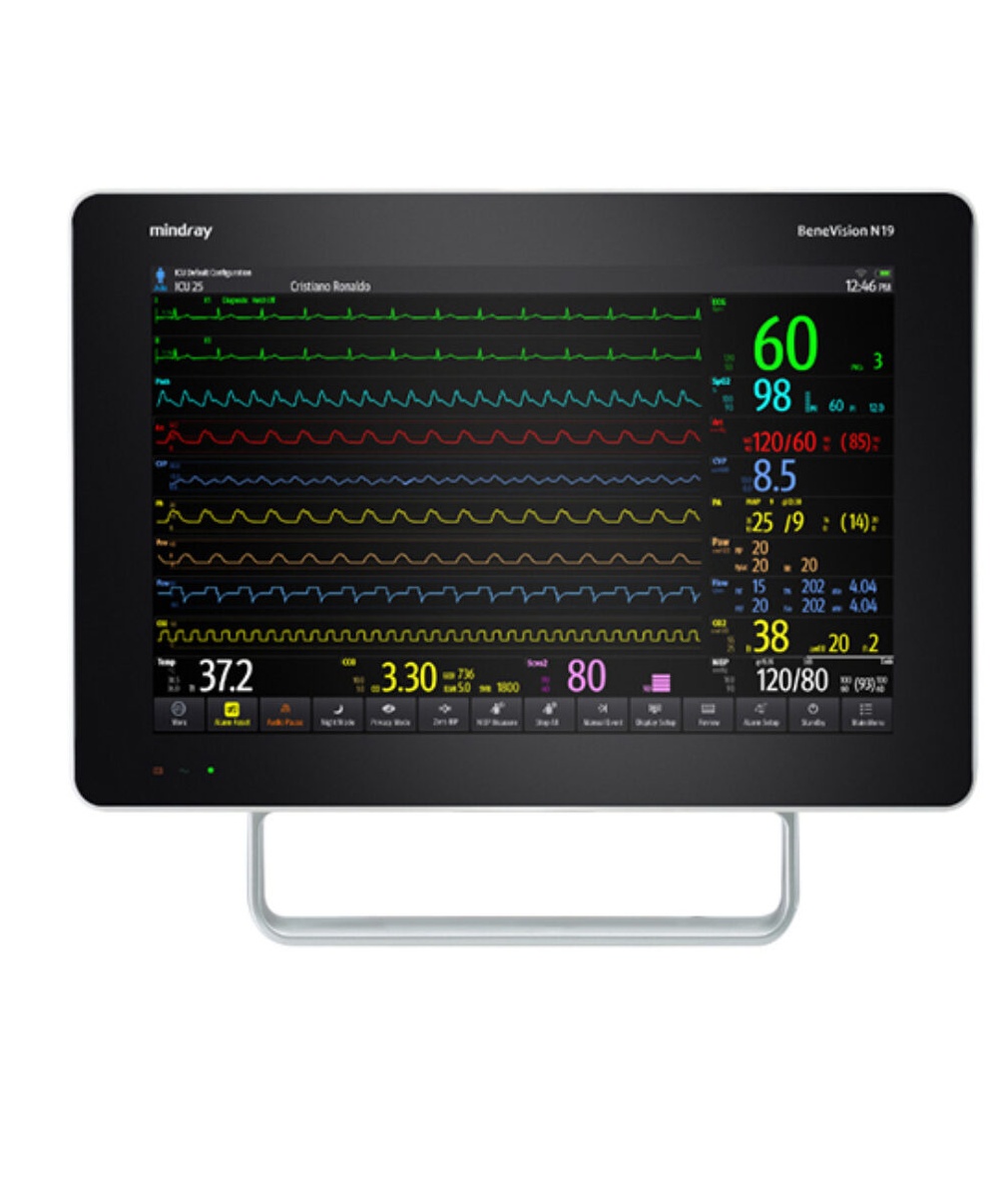 Mindray BeneVision N19 Patient Monitor