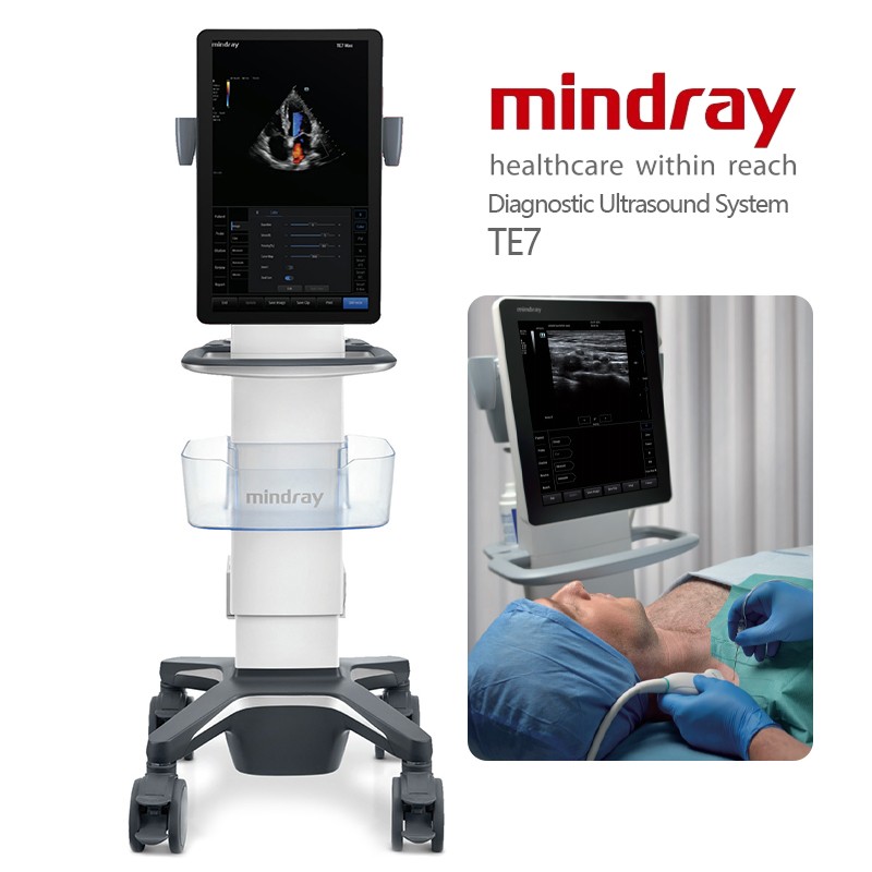 Mindray TE7 Point of Care Ultrasound System